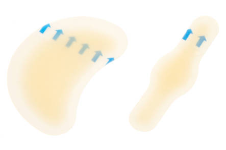 Rakkolaastari for hæler og tær - Sårbehandling - 6410412690999 - 2